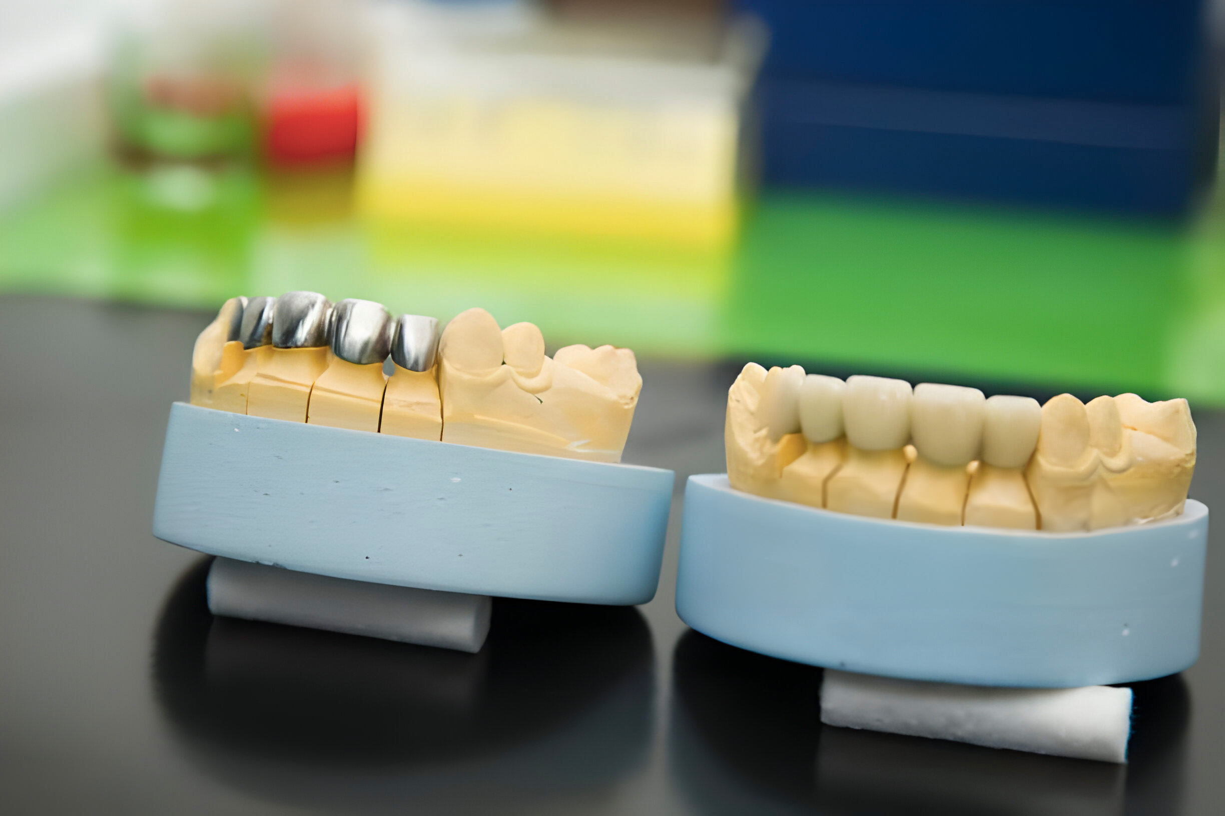 Güleryüz Dental Laboratuvar Porselen Kron & Köprü