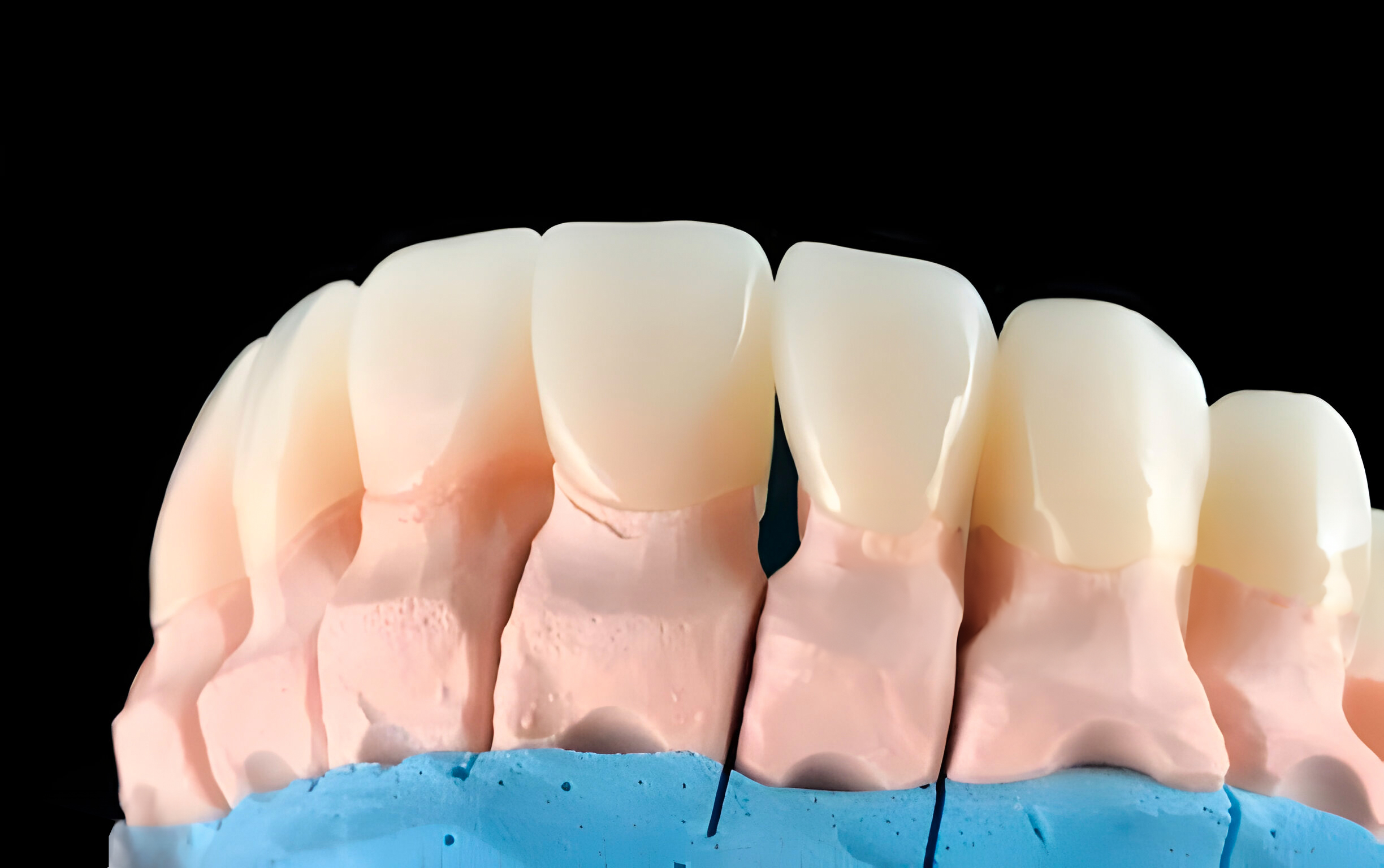 Güleryüz Dental Laboratuvar Zirkonyum Kron & Köprü