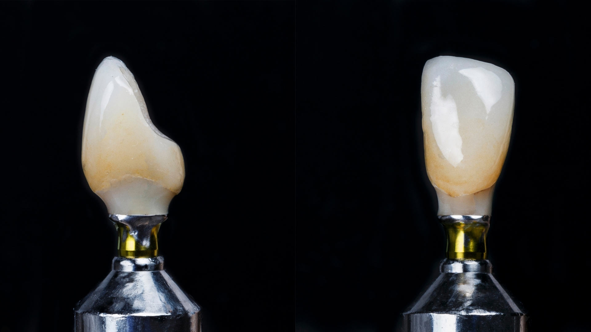 Güleryüz Dental Laboratuvar implant-Costum-Abutment